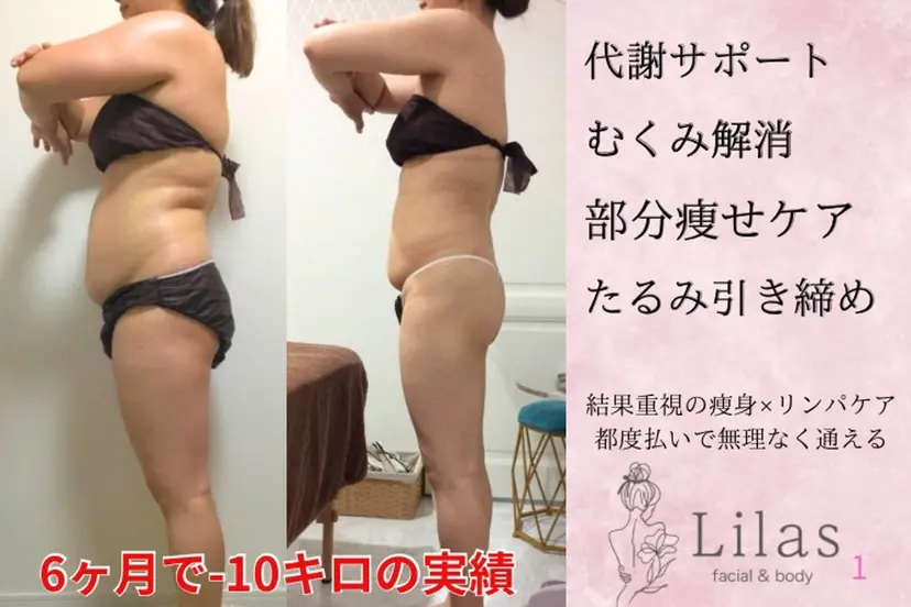 痩身・リンパ専門 Lilas広島駅前店の掲載