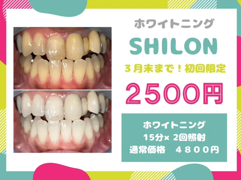 ホワイトニングサロン SHILONの掲載
