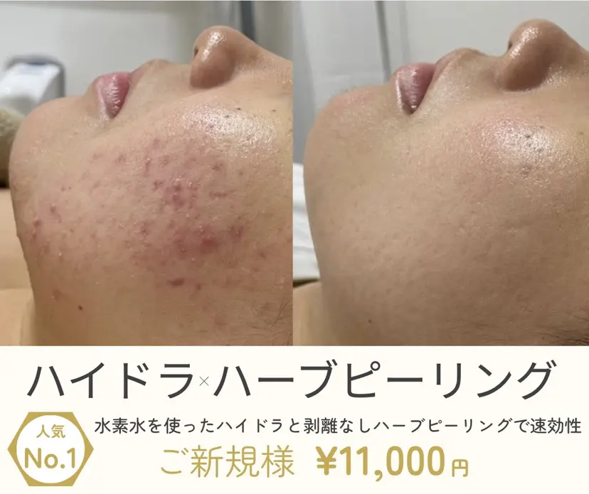 プライベートサロン Belle（ベル）の掲載