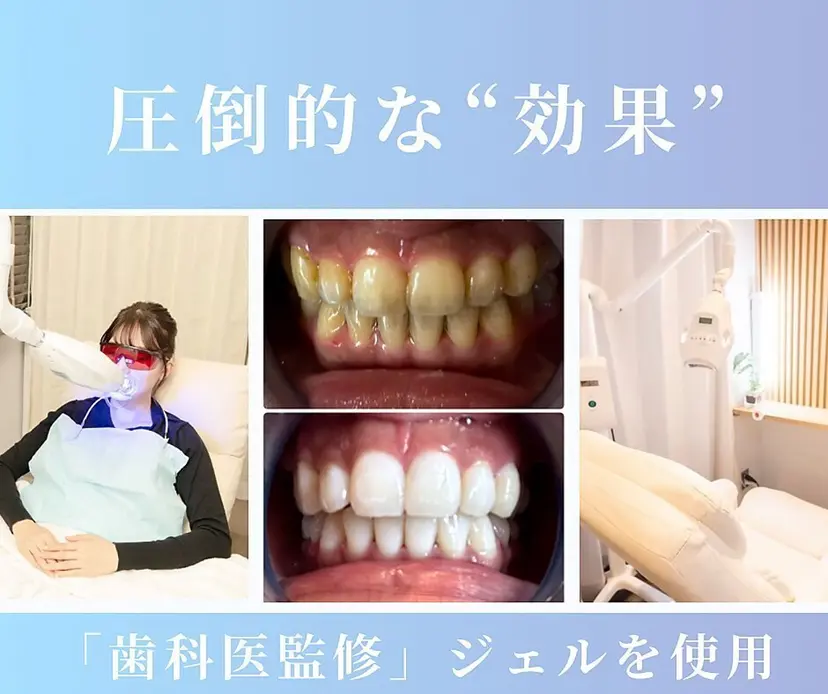 NAホワイトニング 川崎店の掲載