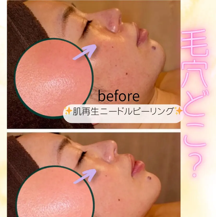 lucia  豊明 肌管理の掲載