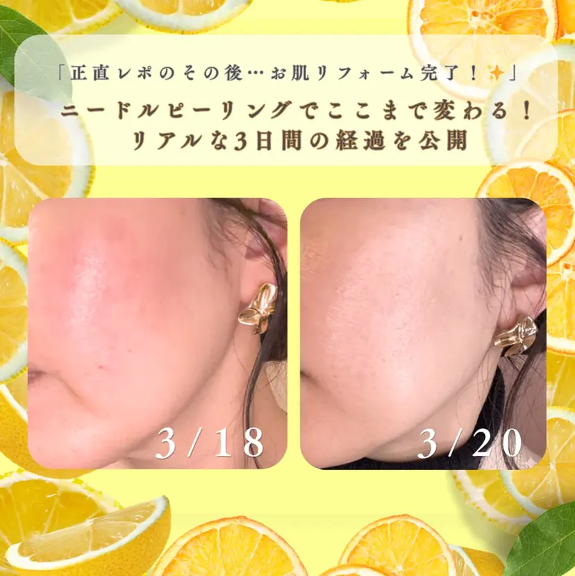 lucia  豊明 肌管理の掲載