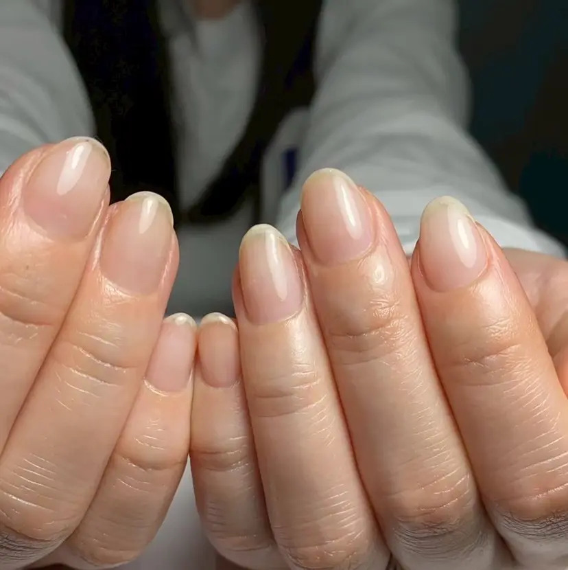 自爪育成 Keshlyの掲載