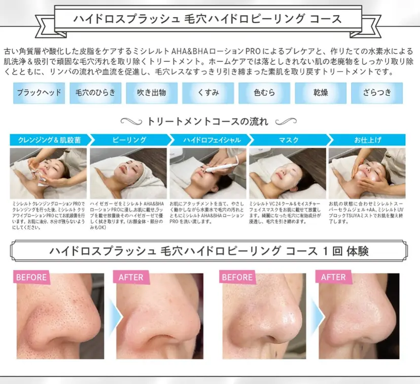 フルフィル MIYUKIの掲載