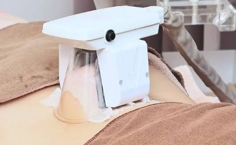 クルスカ リダクションの掲載