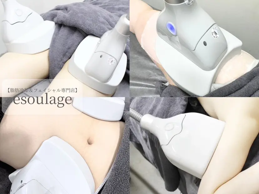 脂肪冷却フェイシャル エスラージュの掲載
