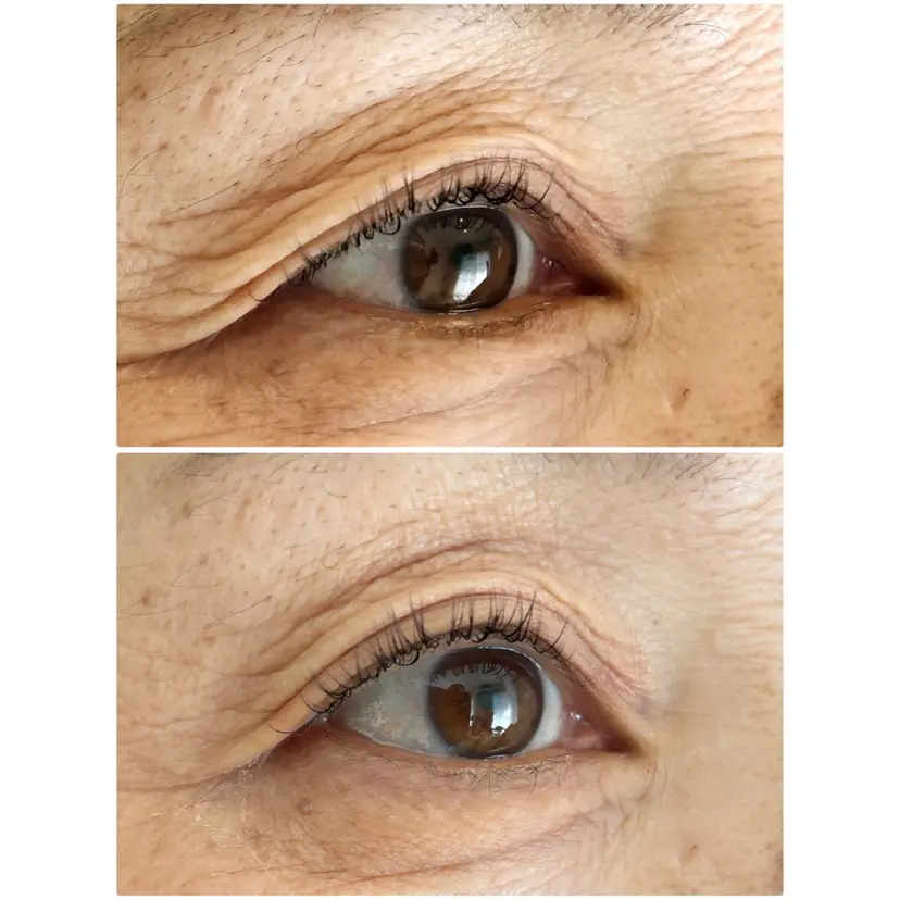 Mysarest 加藤の掲載