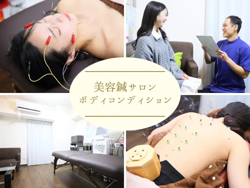 小顔ハーブピーリング 美容鍼/毛穴洗浄の掲載