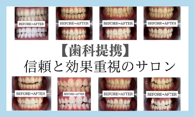 箕浦 乙葉の掲載
