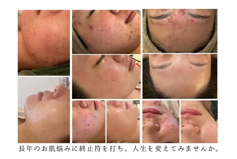 美しぐれ 溝の口店の掲載