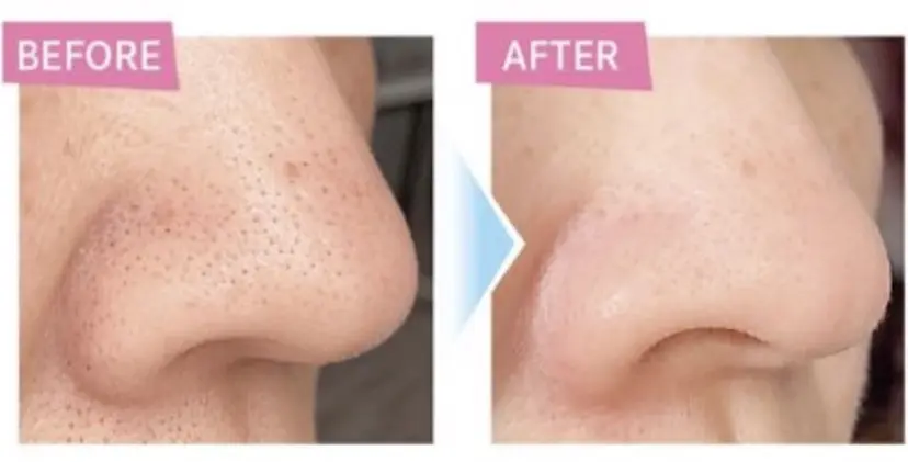 フルフィル名取 MIYUKIの掲載