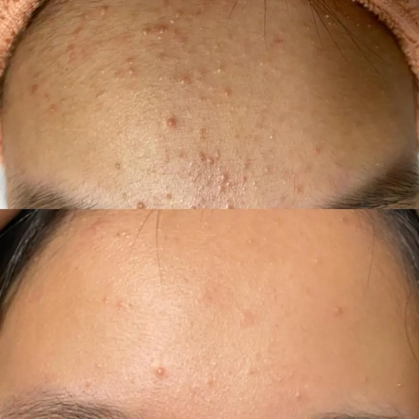 EYE LASH LAPISの掲載