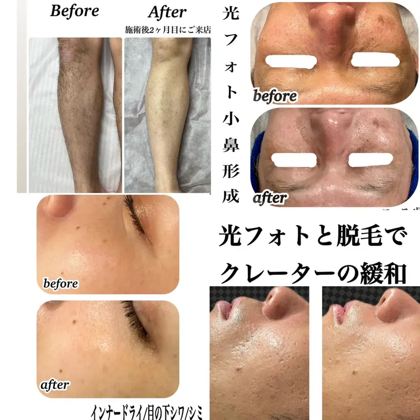 肌質改善/都度脱毛 Mahinaの掲載