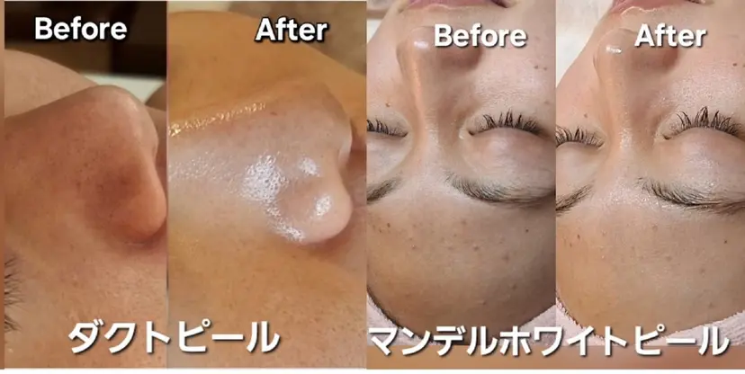 バリューネクスト　 青葉台　sawadaの掲載