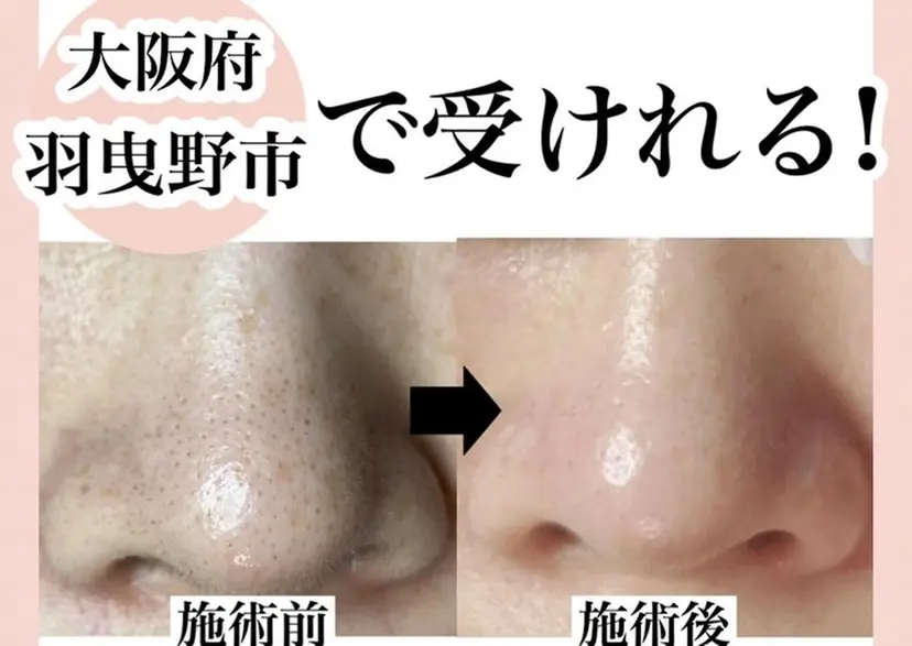 シミケア放題専門 /杉原いくえの掲載