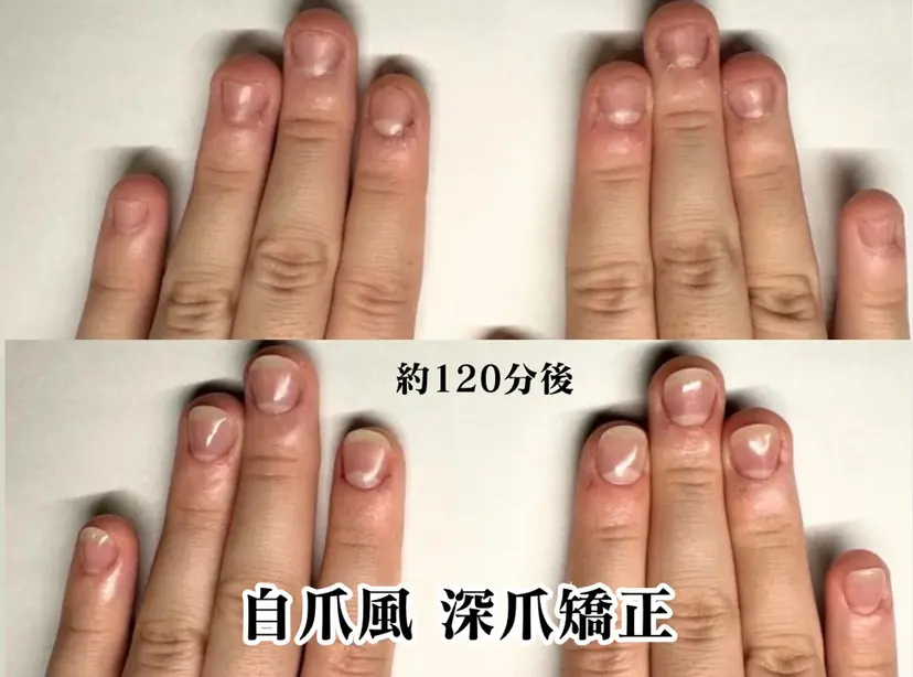 深爪矯正専門店 ネイルサロンKUUの掲載