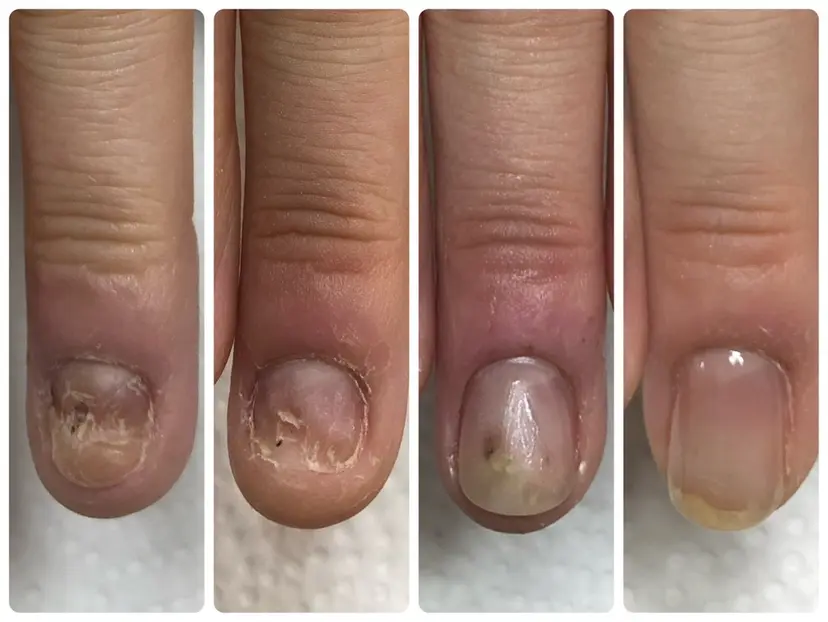 深爪矯正専門サロン リュリュの掲載