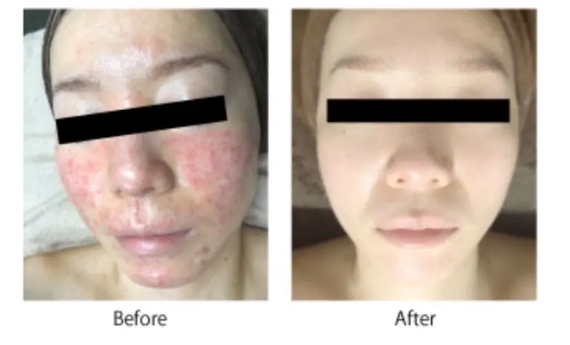 育乳&育肌 Kalmiaカルミアの掲載