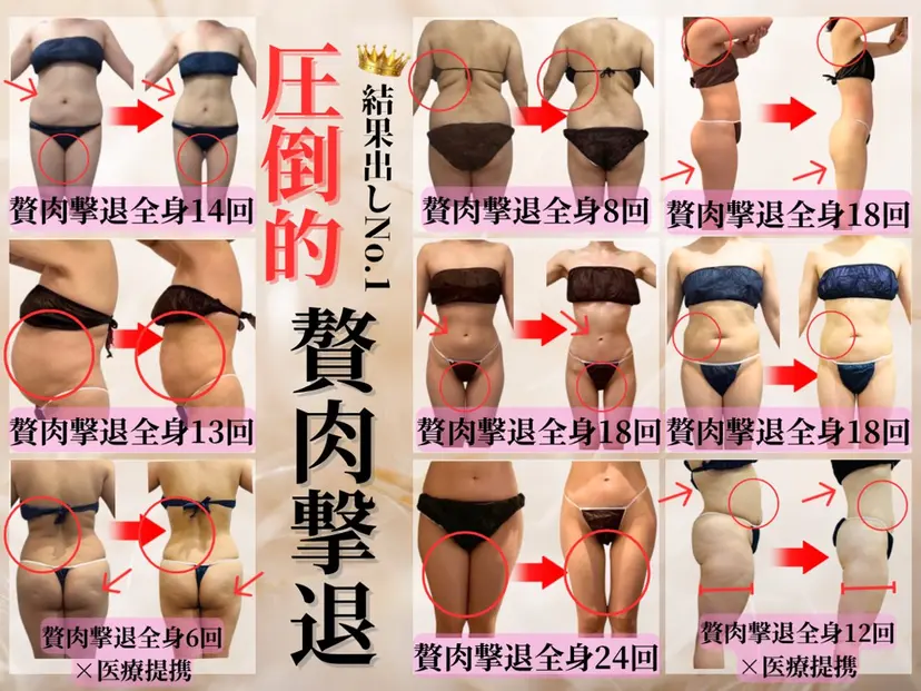 本格痩身＊肌質改善＊ BelleWhiteの掲載