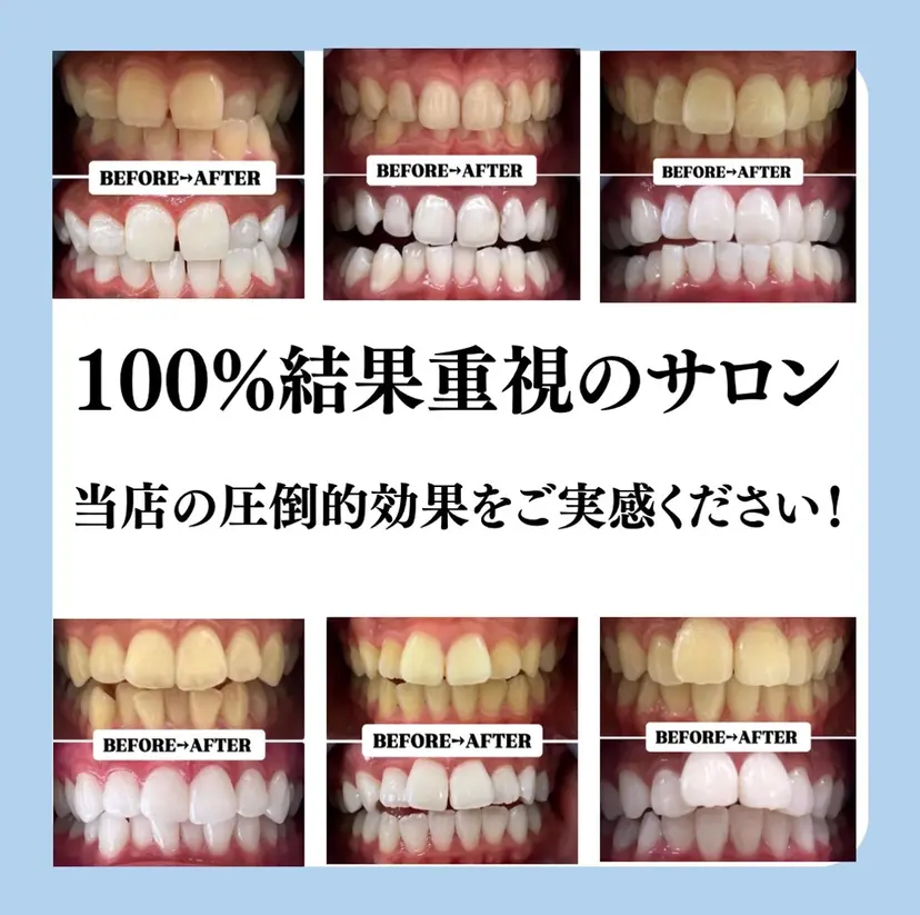 歯科提携サロン ホワイトニング豊中の掲載