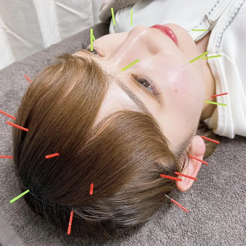 美容鍼・小顔矯正 ハリシェンドの掲載