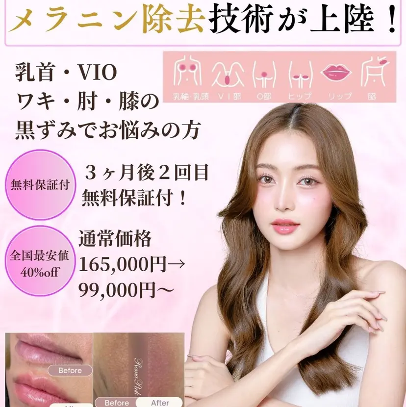 セレーネボーテプラス ローマピンク福岡の掲載