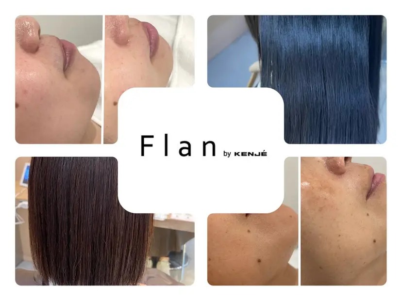 お肌の角質ケア / ベラステギの掲載