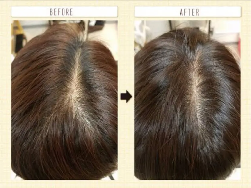 脱毛/ヘッドスパ 山川　詩織の掲載