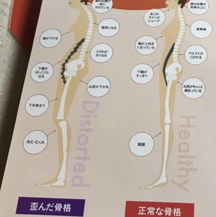 骨盤矯正　SA ゆかりの掲載