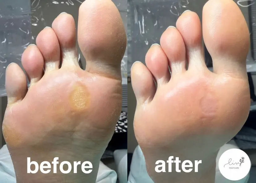 Lise footcareの掲載