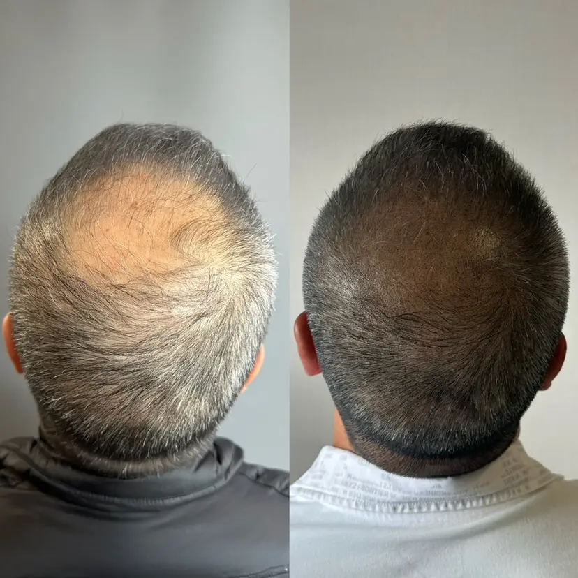 VENUS ☪︎ ｜薄毛改善・痩身の掲載