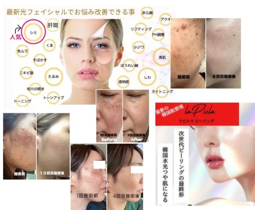 希映 -kieの掲載