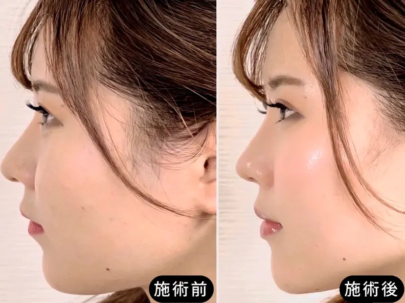 渋谷 小顔美容鍼 専門サロン YZの掲載