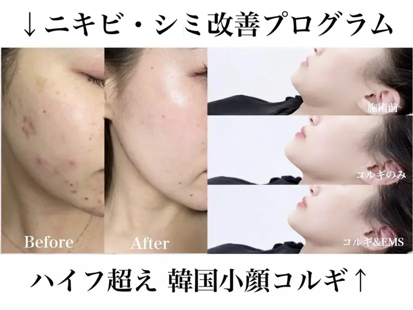 魔法のシミ取り職人 CHIKAの掲載