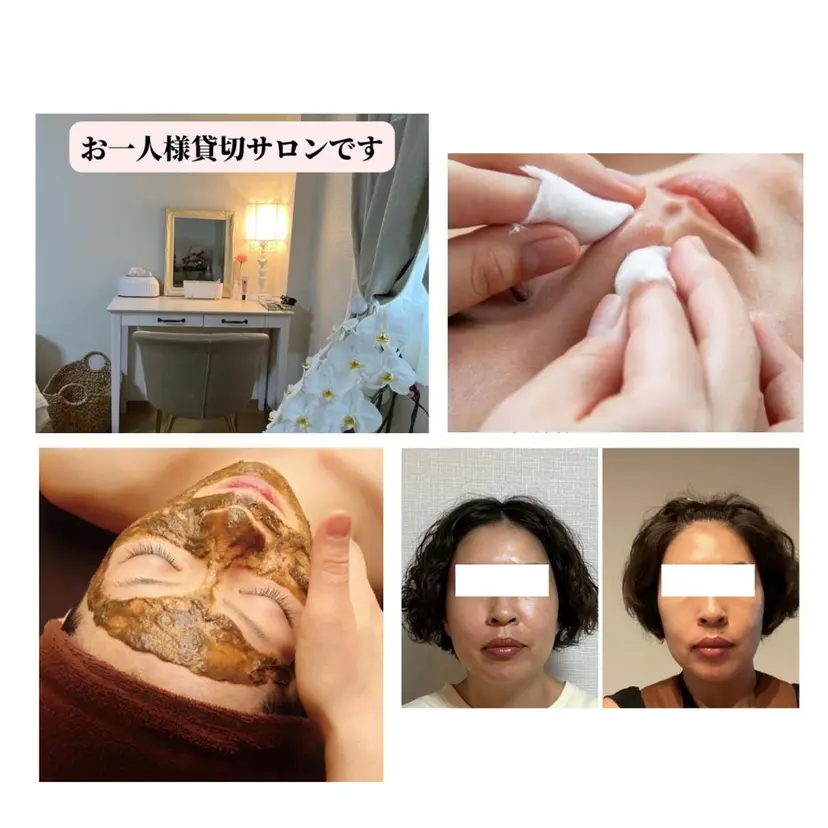 小顔・毛穴専門 ルシェルの掲載