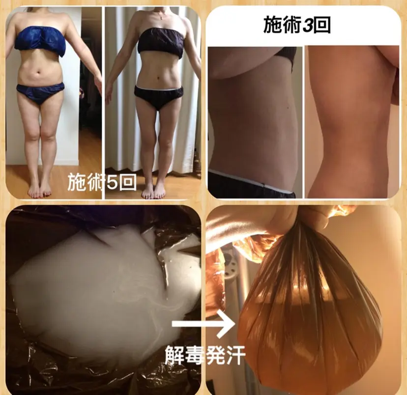 【痩身】インドエステ ＆筋膜リリースの掲載