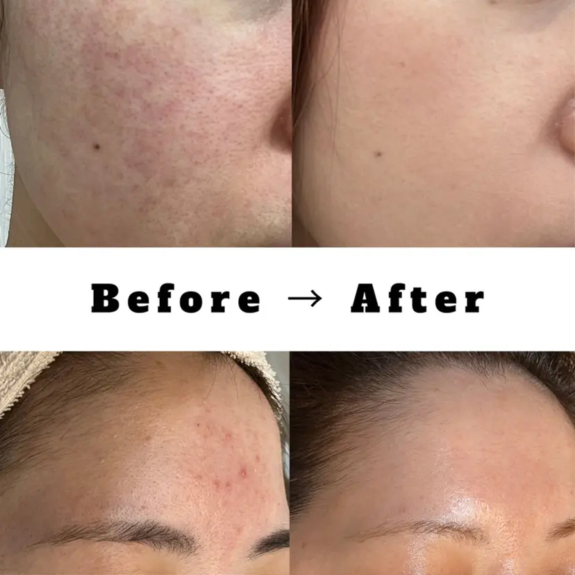 美肌育成サロン Molek(モレ)の掲載