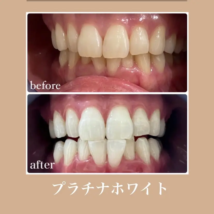 ホワイトニングサロン レアの掲載