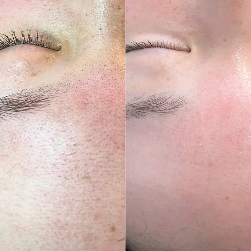 フェイシャルエステ 🫧琉衣の掲載