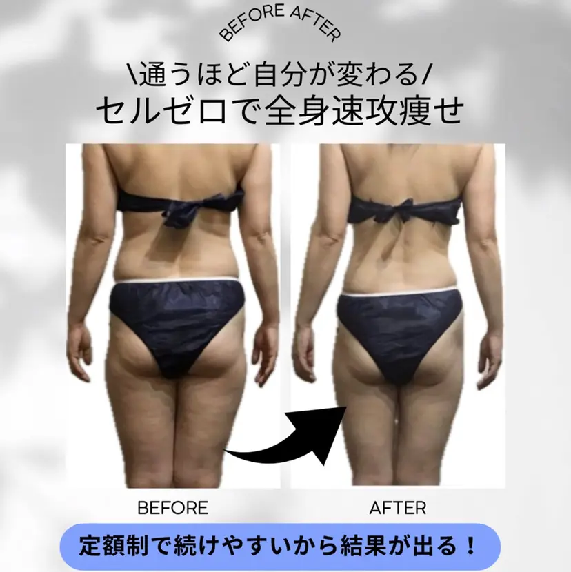 月額制痩身エステ FLORIAの掲載