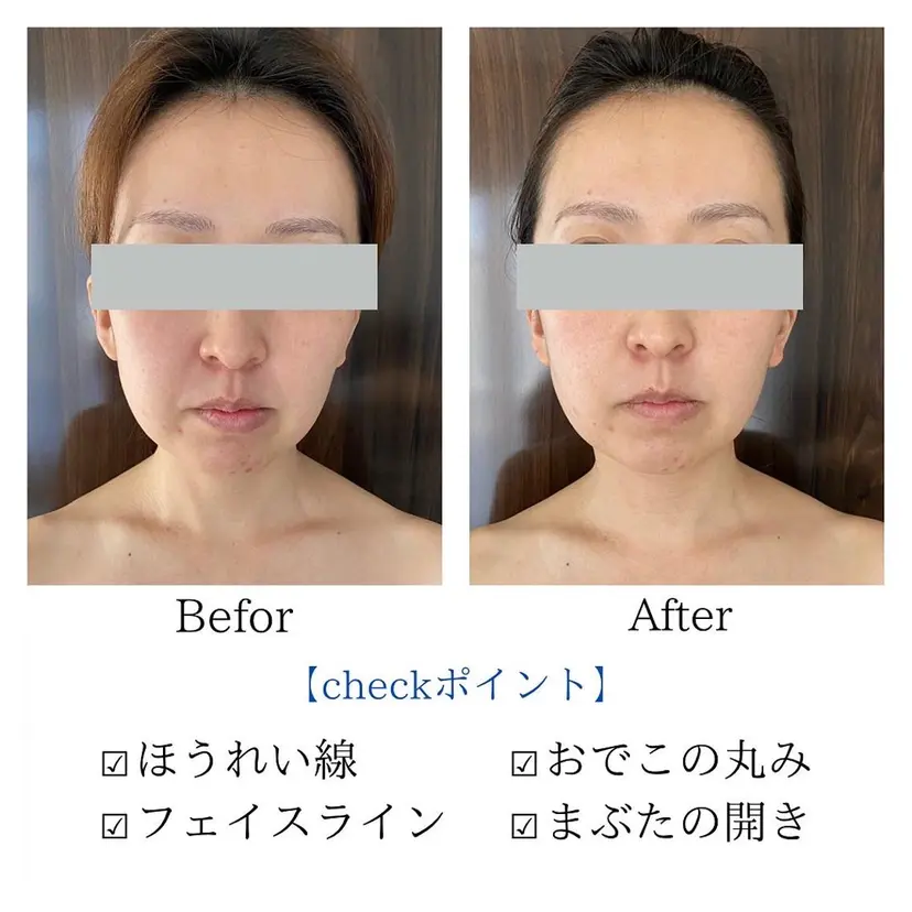 PARAFUSE. AKEMIの掲載