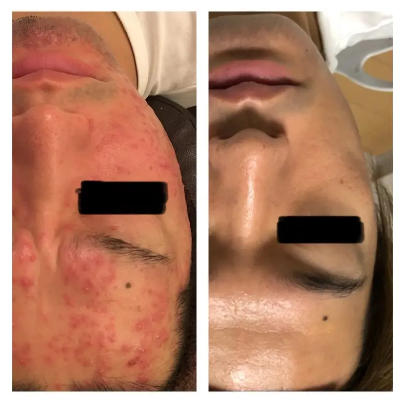 肌質を変えて すっぴん肌に✨の掲載