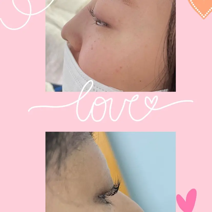 エイジング小顔 阿彦の掲載