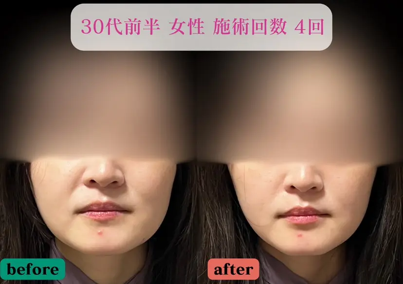 美容とカラダの鍼灸 サロン やなけんの掲載