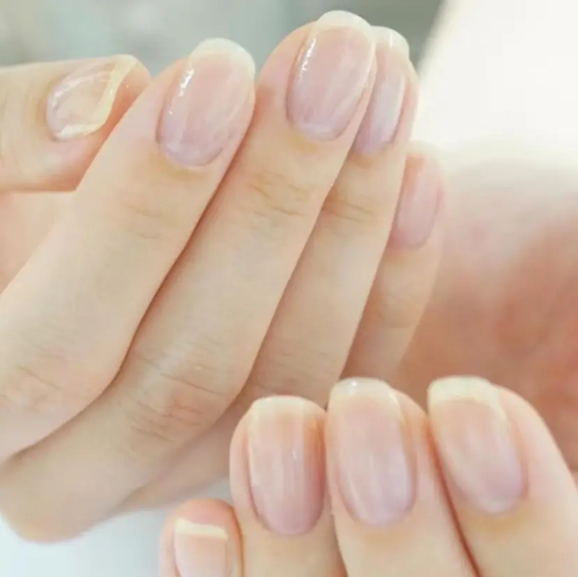 自爪育成専門店 Kapilinaの掲載