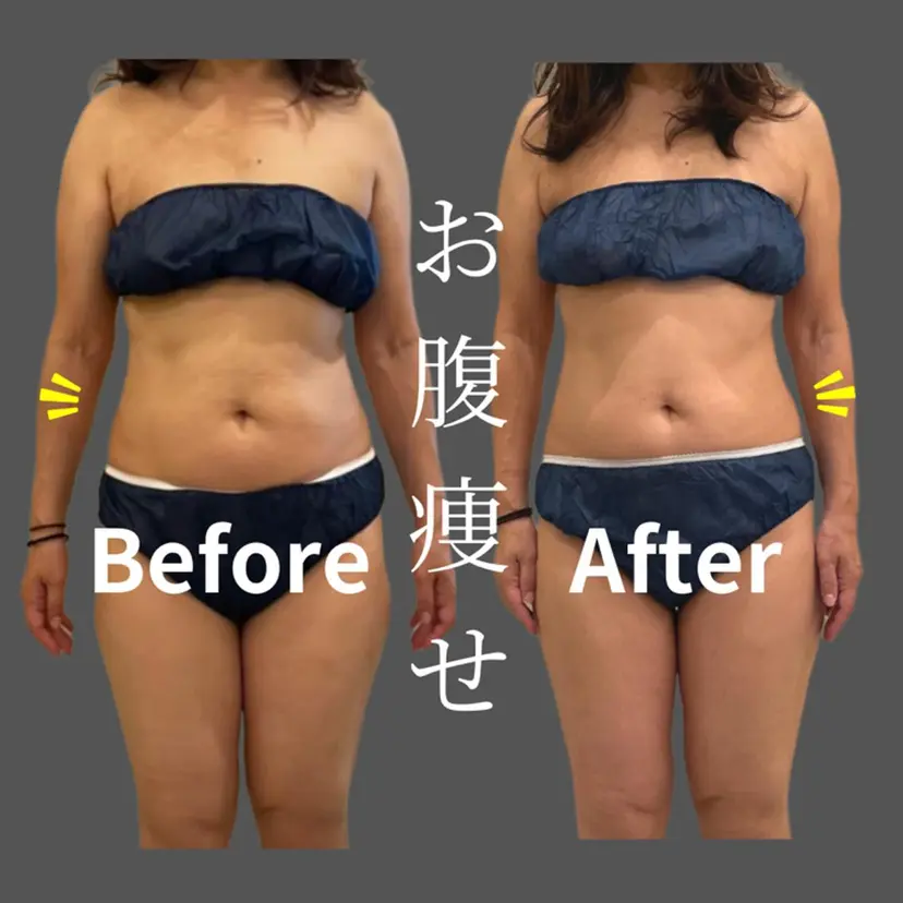 RENATA🕊 脂肪冷却専門店六本木の掲載