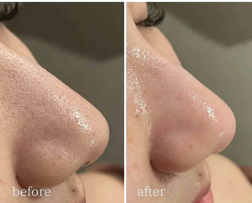 レイエステティック 江南店の掲載