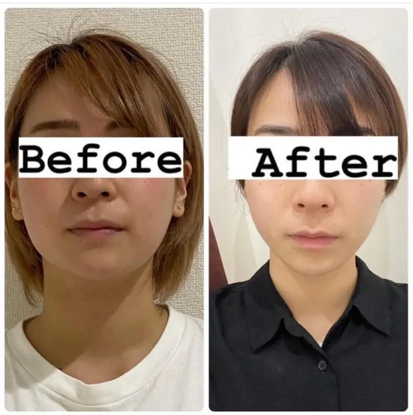 メディカルエステ 東銀座店の掲載