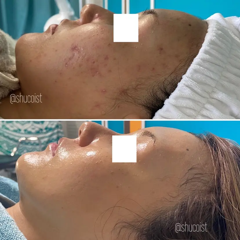 メンズ歓迎🙆♀️ エステ/ネイルISTの掲載