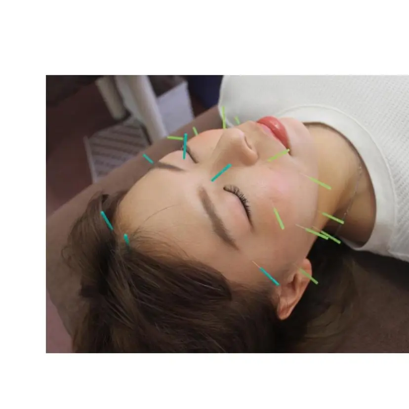 同心整骨院 美容鍼・整体・小顔の掲載